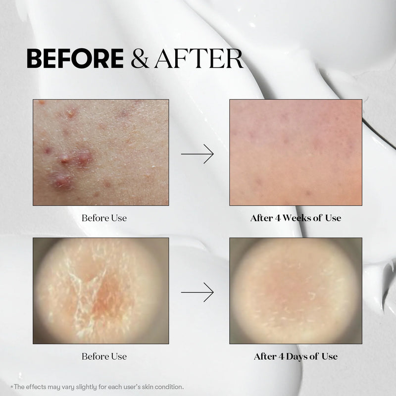 Reedle Shot 300 (50ml) - Skin Cupid