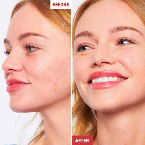 Erborian CC Cream (15ml)- 3 shades  BEFORE AFTER